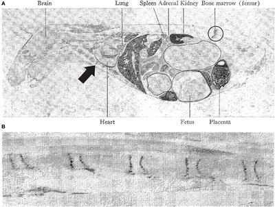 Mercury Is Taken Up Selectively by Cells Involved in Joint, Bone, and Connective Tissue Disorders